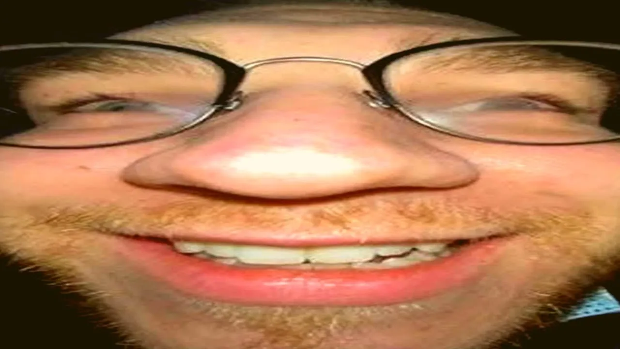 Ohnepixel